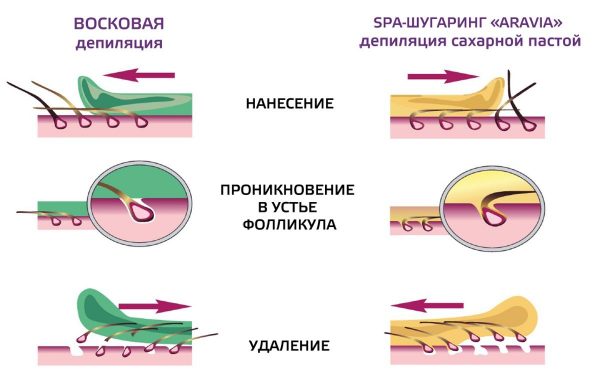 Схема процедур шугаринга и ваксинга