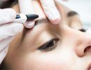 Электроэпиляция лица
