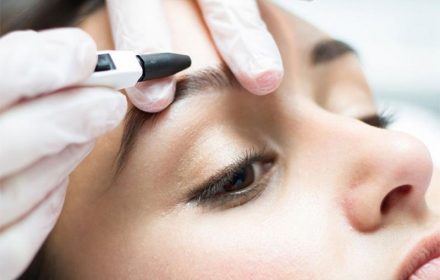 Электроэпиляция лица