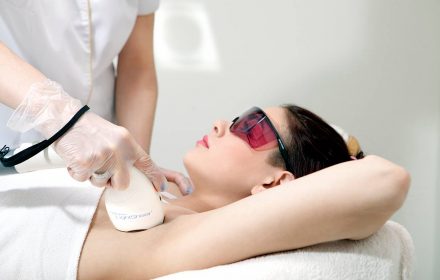 лазерная эпиляция