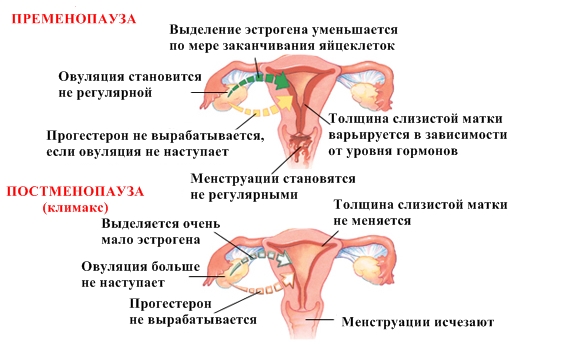 Изменения репродуктивной системы во время пременопаузы и климакса